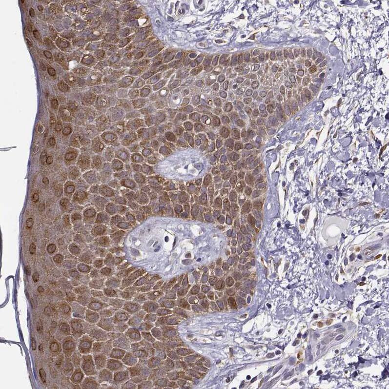 Staining of human skin shows strong cytoplasmic positivity in squamous epithelial cells.