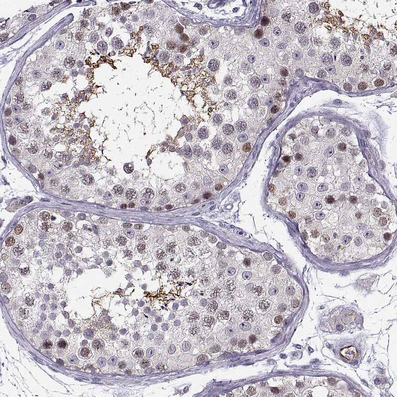 Staining of human testis shows moderate nuclear and cytoplasmic positivity in cells in seminiferous ducts.