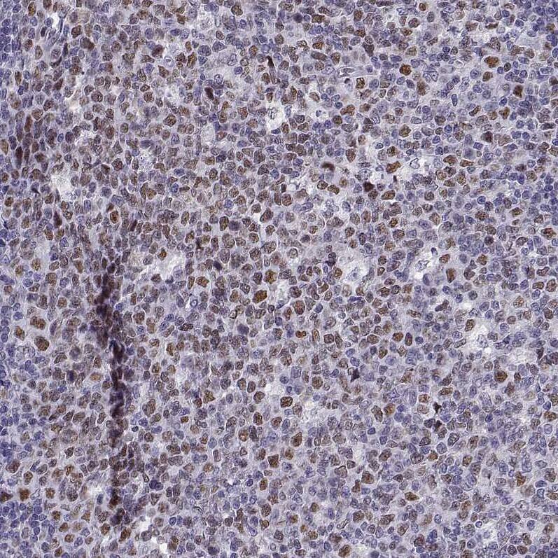 Staining of human tonsil shows moderate nuclear positivity in germinal center cells.