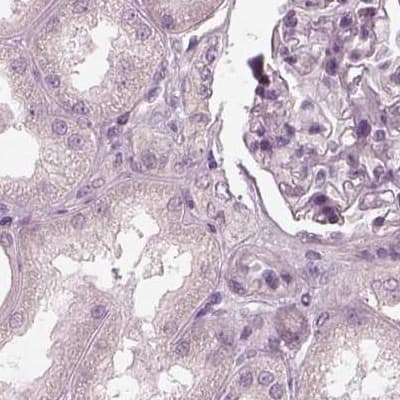 Staining of human kidney.