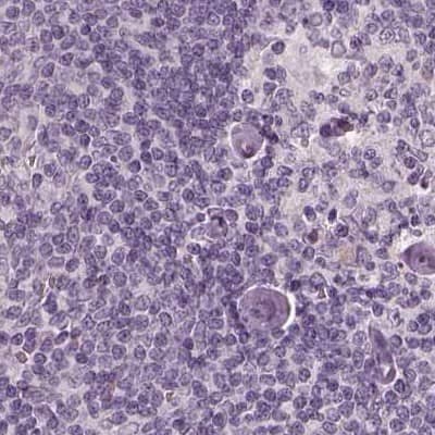 Staining of human lymph node.