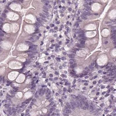 Staining of human duodenum.