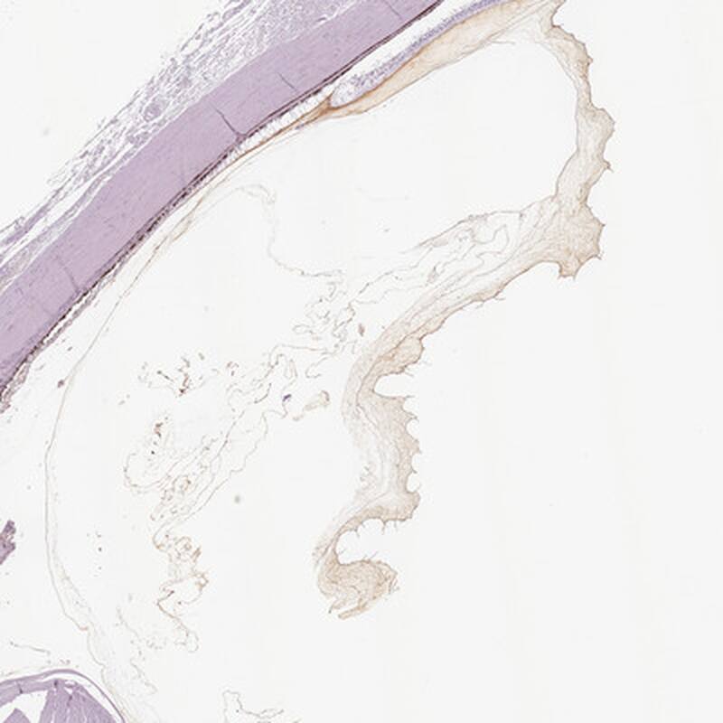 Staining of human eye.