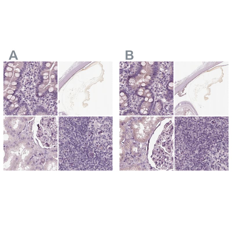 <b>Orthogonal Strategies Validation. </b>Staining of human duodenum, eye, kidney and lymph node HPA034952 (A) shows similar protein distribution across tissues to independent antibody HPA034951 (B).