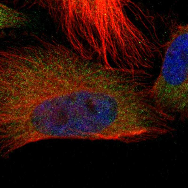 Staining of human cell line U-251 MG shows localization to cytosol.