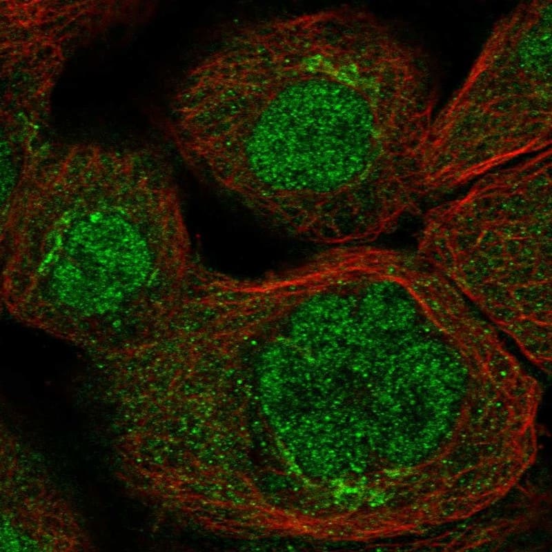 Staining of human cell line A-431 shows localization to nucleoplasm & the Golgi apparatus.