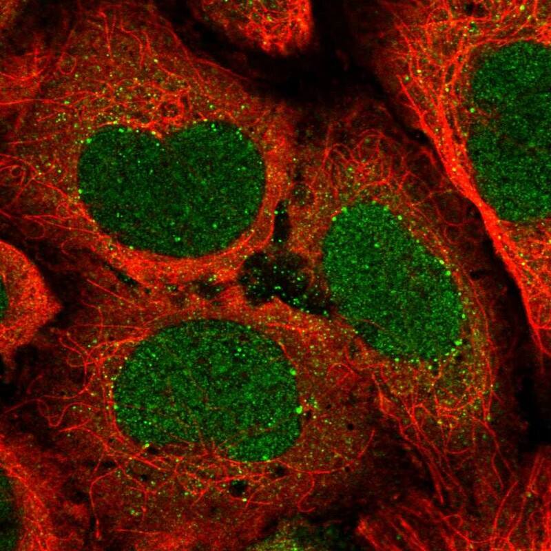 Staining of human cell line U-2 OS shows localization to nucleus, cytosol & vesicles.