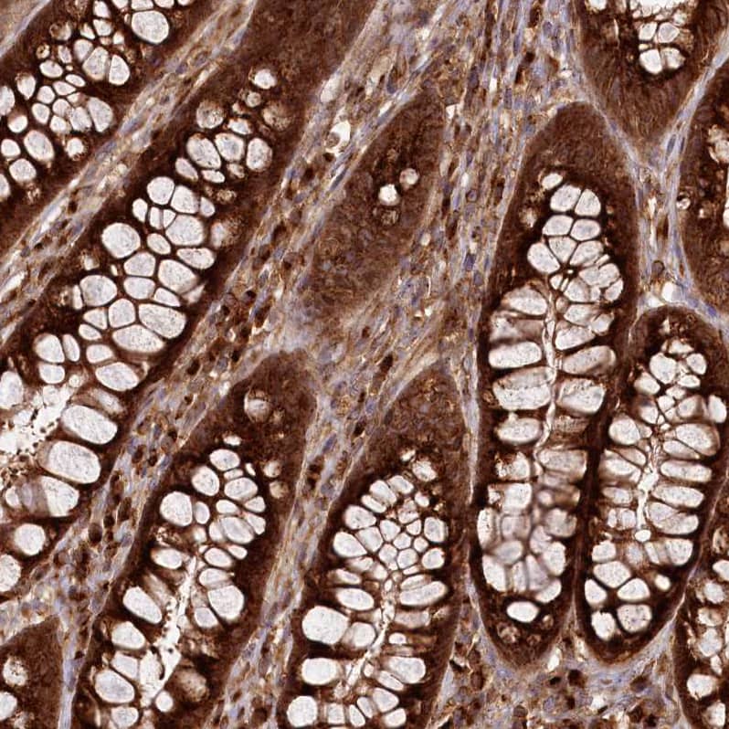 Staining of human rectum shows strong cytoplasmic positivity in glandular cells.