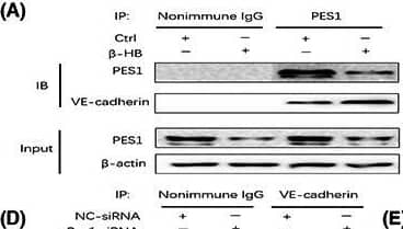 Western Blot Pescadillo Antibody - BSA Free