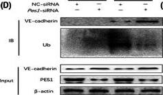  beta ‐HB treatments decreased PES1‐facilitated VE‐cadherin ubiquitination in MVECs. (A–C)  beta ‐HB increased the interaction between PES1 and VE‐cadherin. (D–G) Knockdown of Pes1 in cultured cells extenuated the ubiquitination of VE‐cadherin. (H–K) Overexpression of Pes1 in cultured cells promoted the ubiquitination of VE‐cadherin, which was curbed by  beta ‐HB treatment. Each experiment was performed independently three times. ***p < 0.001 compared with control (anova, Student–Newman–Keuls q‐test). Image collected and cropped by CiteAb from the following open publication (//pubmed.ncbi.nlm.nih.gov/37060584), licensed under a CC-BY license. Not internally tested by Novus Biologicals.