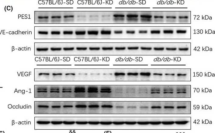 Western Blot Pescadillo Antibody - BSA Free