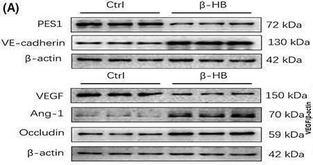  beta ‐HB treatment reduced vascular endothelial paracellular permeability in vitro. (A, B) The protein levels of PES1, VEGF, VE‐cadherin, Ang‐1 and Occludin in MVECs were detected by immunoblotting after 2 mM  beta ‐HB treatment for 24 h. (C–H) Displayed are immunofluorescence images of  beta ‐HB‐treated MVECs for VE‐cadherin, VEGF and PES1 expression and localizations, scale bar represents 20 μm. The nuclei were stained with DAPI. (I) Exhibited is the paracellular permeability in the cultured MVECs under different treatments. Ctrl (Control),  beta ‐HB ( beta ‐hydroxybutyric acid). Data were represented as mean +/- SEM, each experiment was performed independently three times. **p < 0.01, ***p < 0.001 compared with control (Student's t‐test). Image collected and cropped by CiteAb from the following open publication (//pubmed.ncbi.nlm.nih.gov/37060584), licensed under a CC-BY license. Not internally tested by Novus Biologicals.