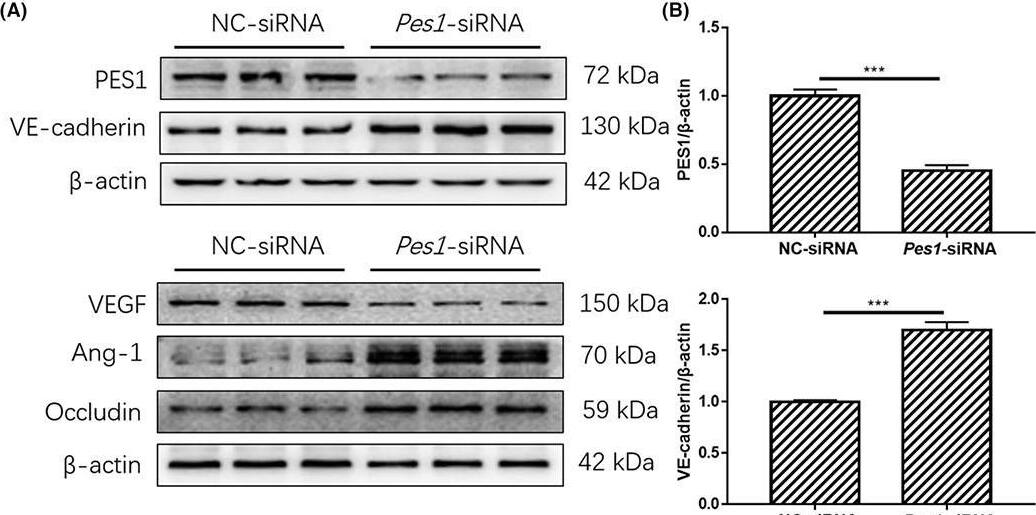 In vitro knockdown of Pes1 lowered the paracellular permeability of MVECs. (A, B) The protein levels of PES1, VEGF, VE‐cadherin, Ang‐1 and Occludin in MVECs were detected by immunoblotting after Pes1‐siRNA treatment. (C, D) Shown are immunofluorescence images of Pes1‐siRNA‐treated MVECs for Occludin and VE‐cadherin expression and localizations, scale bar represents 20 μm. The nuclei were stained with DAPI. (E) Exhibited is the paracellular permeability in the cultured MVECs in different groups. Data were represented as mean +/- SEM, each experiment was performed independently three times. **p < 0.01, ***p < 0.001 compared with control (Student's t‐test). Image collected and cropped by CiteAb from the following open publication (//pubmed.ncbi.nlm.nih.gov/37060584), licensed under a CC-BY license. Not internally tested by Novus Biologicals.