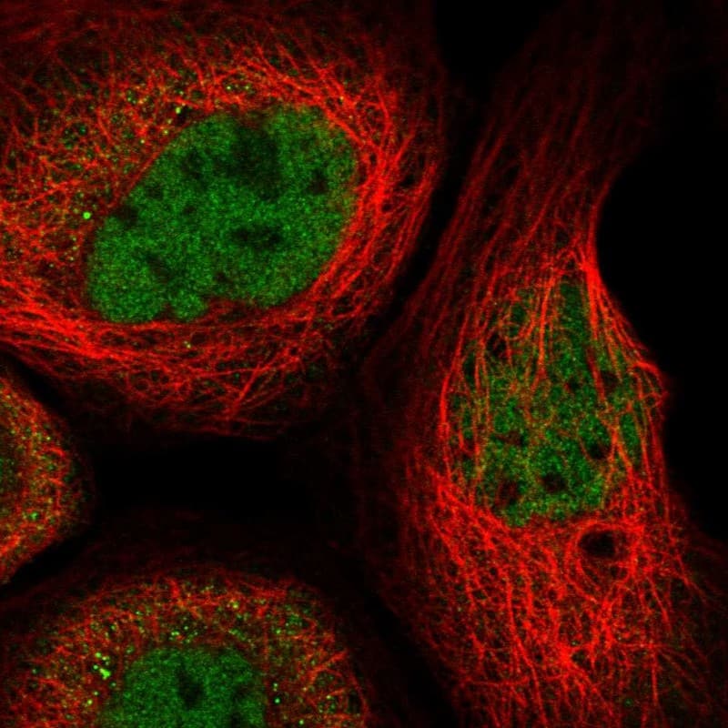 Staining of human cell line A-431 shows localization to nucleoplasm.