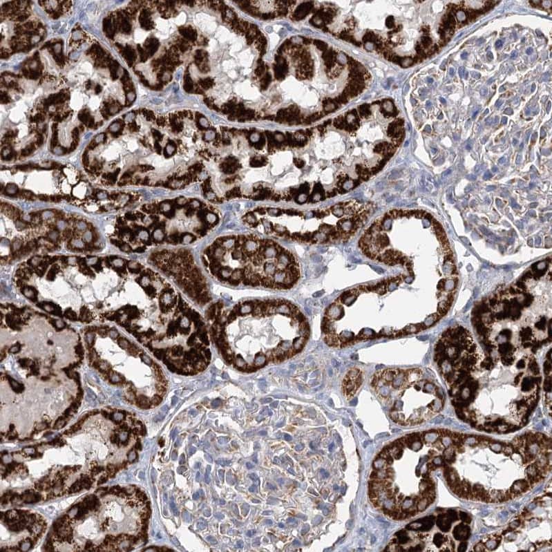 Immunohistochemistry-Paraffin DHTKD1 Antibody - BSA Free
