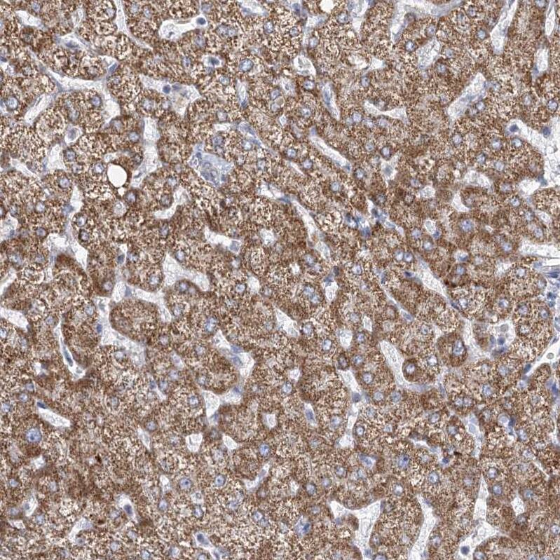 Immunohistochemistry-Paraffin DHTKD1 Antibody - BSA Free