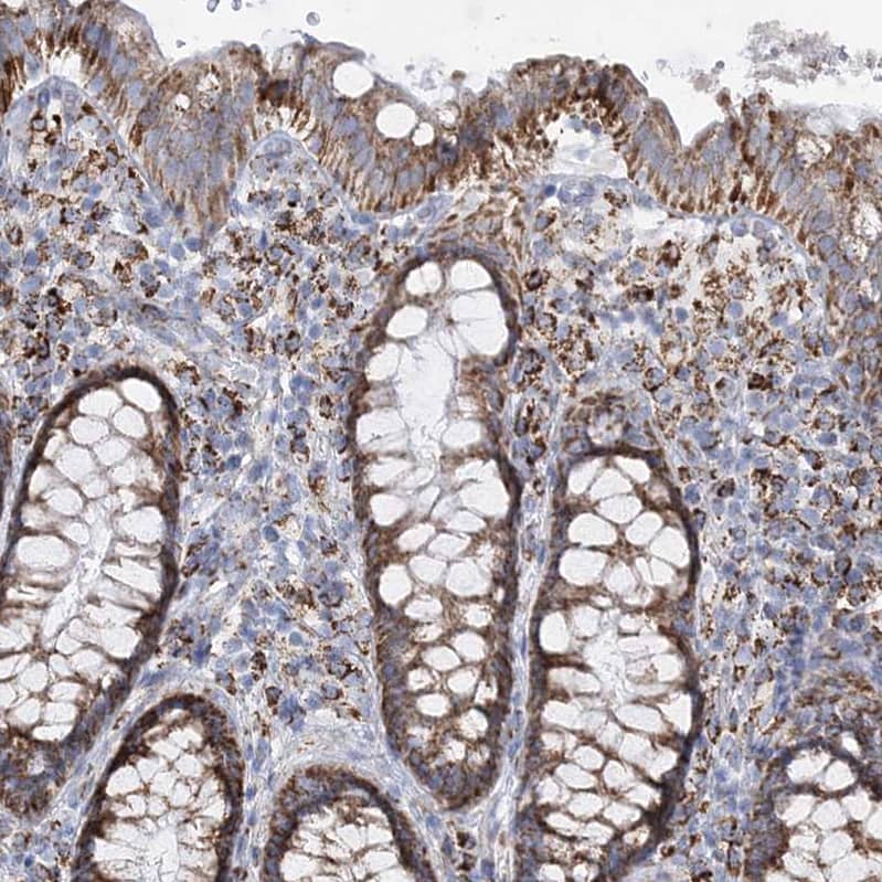 Immunohistochemistry-Paraffin DHTKD1 Antibody - BSA Free