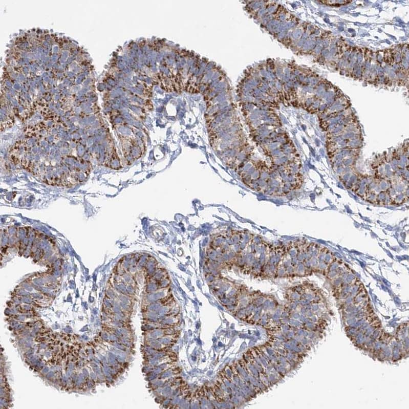Immunohistochemistry-Paraffin DHTKD1 Antibody - BSA Free