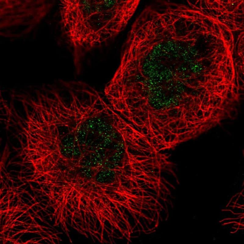 Staining of human cell line A-431 shows localization to nucleoplasm.