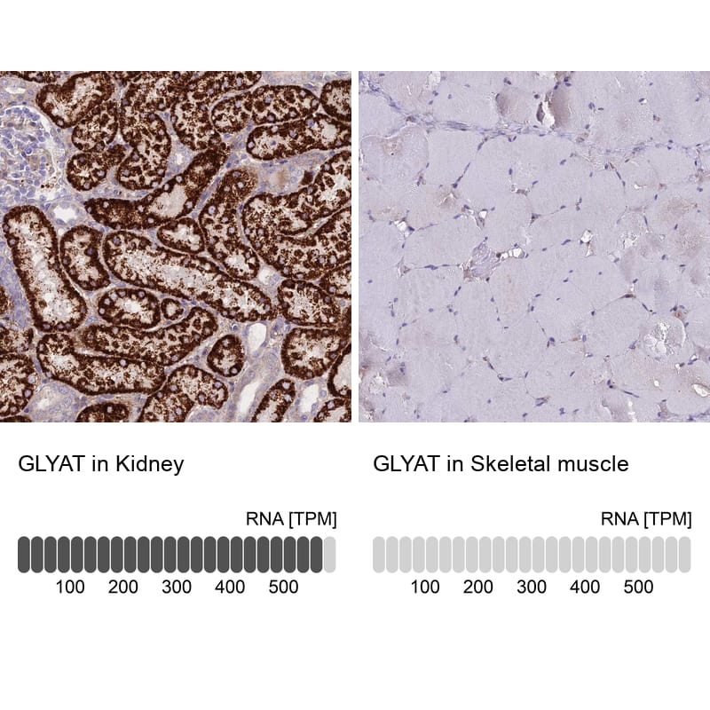 Immunohistochemistry-Paraffin GLYAT Antibody - BSA Free