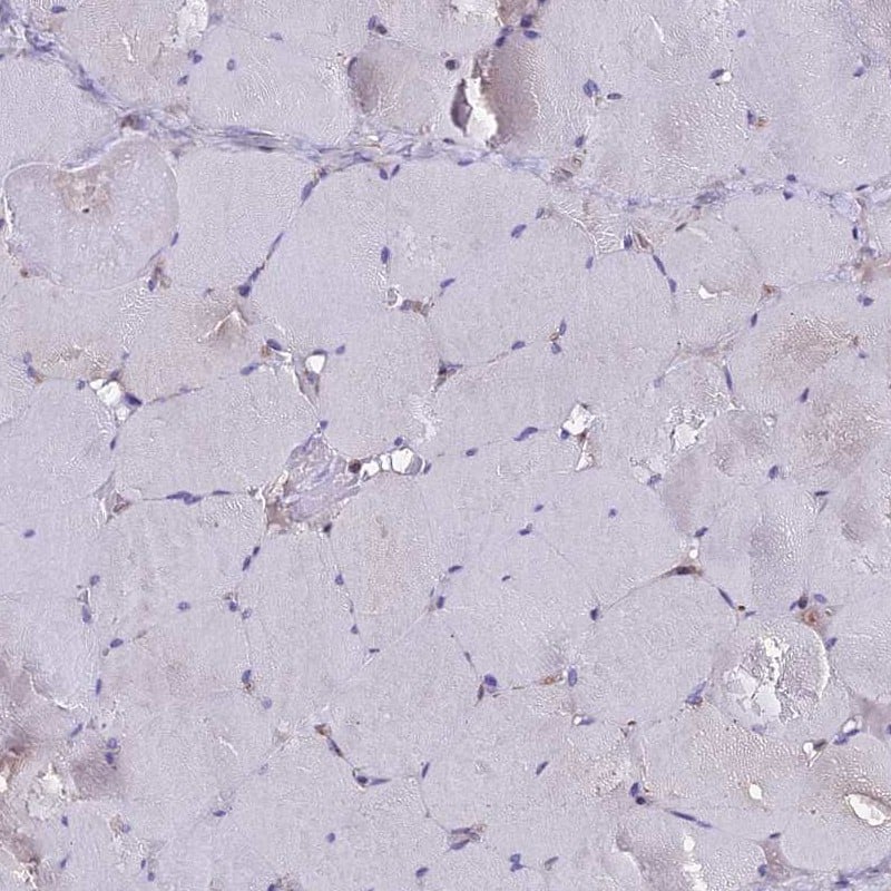 Immunohistochemistry-Paraffin GLYAT Antibody - BSA Free