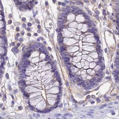 Immunohistochemistry-Paraffin GLYAT Antibody - BSA Free