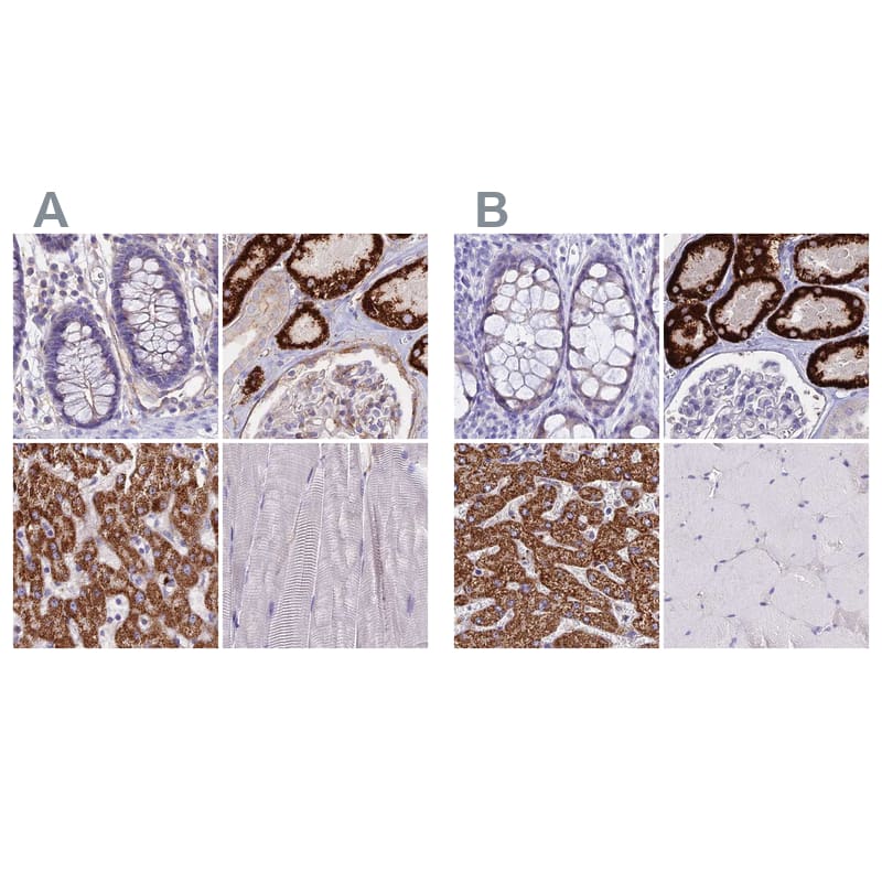 Immunohistochemistry-Paraffin GLYAT Antibody - BSA Free