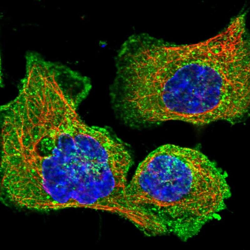 Staining of human cell line A-431 shows localization to plasma membrane, cytosol & vesicles.