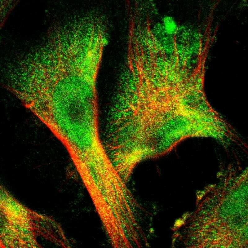 Staining of human cell line U-251 MG shows localization to nucleoplasm & cytosol.