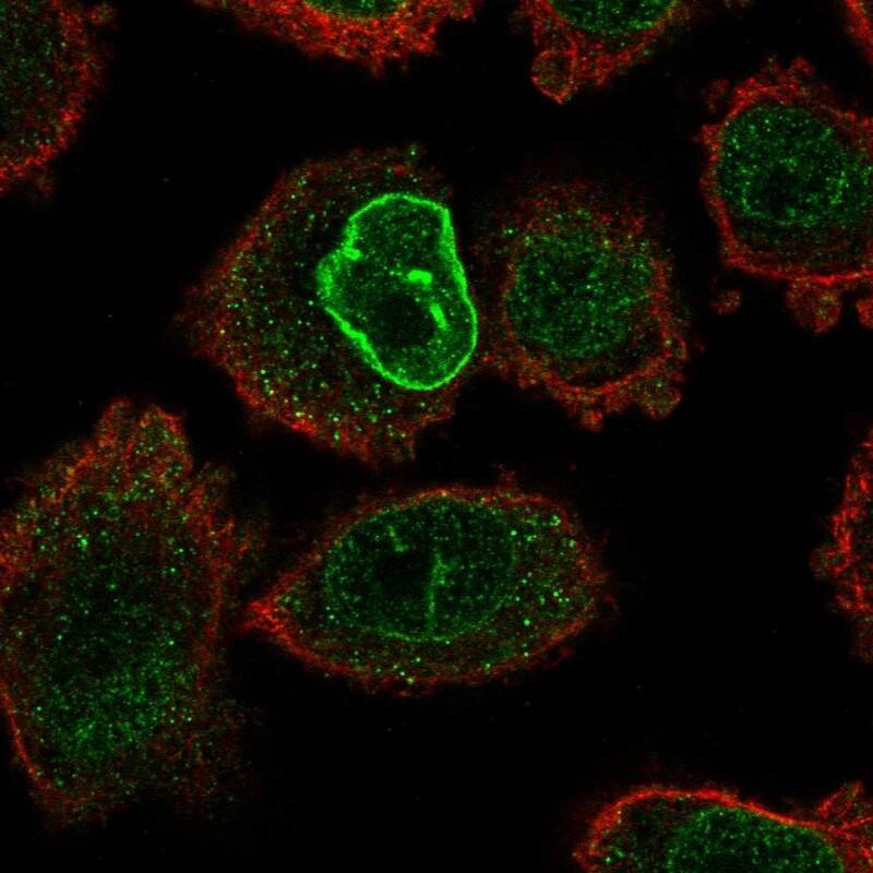 Staining of human cell line PC-3 shows localization to nucleoplasm & nuclear membrane.
