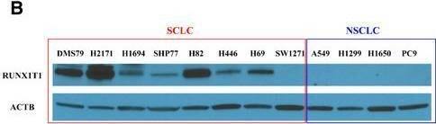 Western Blot RUNX1T1/ETO Antibody - BSA Free