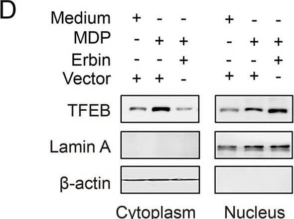 Erbin promotes TFEB nuclear translocation and transcription activity. A Erbinfl/fl and Erbinfl/fl/Lyz2−cre BMDMs were treated with MDP for 6 h, and western blotting was used to estimate the protein levels of total TFEB and pTFEB (S211). B THP-1 macrophages were transfected with vector control or HA-Erbin for 36 h prior to western blot assays. C BMDMs were treated with 10μg/ml MDP for 6 h and then incubated with TFEB antibody. The fluorescence intensity of treated cells was measured by confocal microscopy. Scale bar: 25 μm. D THP-1 macrophages were transfected with vector control or HA-Erbin for 36 h. Then, cells were treated with or without MDP (10 μg/ml) for 6 h. Cytosolic and nuclear extracts were prepared and subjected to western blot analyses. Lamin A and  beta -actin were used as the internal control for nuclear and cytosolic fractions, respectively. E Experiments were performed similarly to those in D, except indicated siRNA was used. F THP-1 macrophages were transfected with siRNA control or si-Erbin for 36 h and treated with or without MDP (10 μg/ml) for 6 h before qPCR analyses. The data shown are representative of 3 independent experiments Image collected and cropped by CiteAb from the following open publication (//pubmed.ncbi.nlm.nih.gov/38105228), licensed under a CC-BY license. Not internally tested by Novus Biologicals.