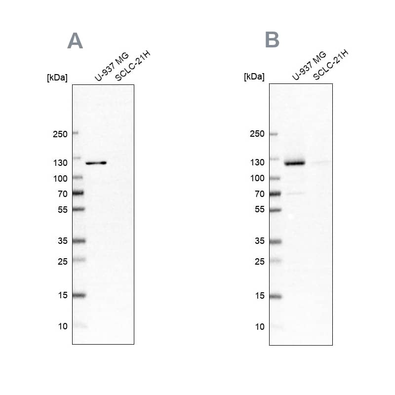 <b>Independent Antibodies Validation. </b>Analysis using NBP2-56320 (A) shows similar pattern to independent antibody NBP1-82843 (B).