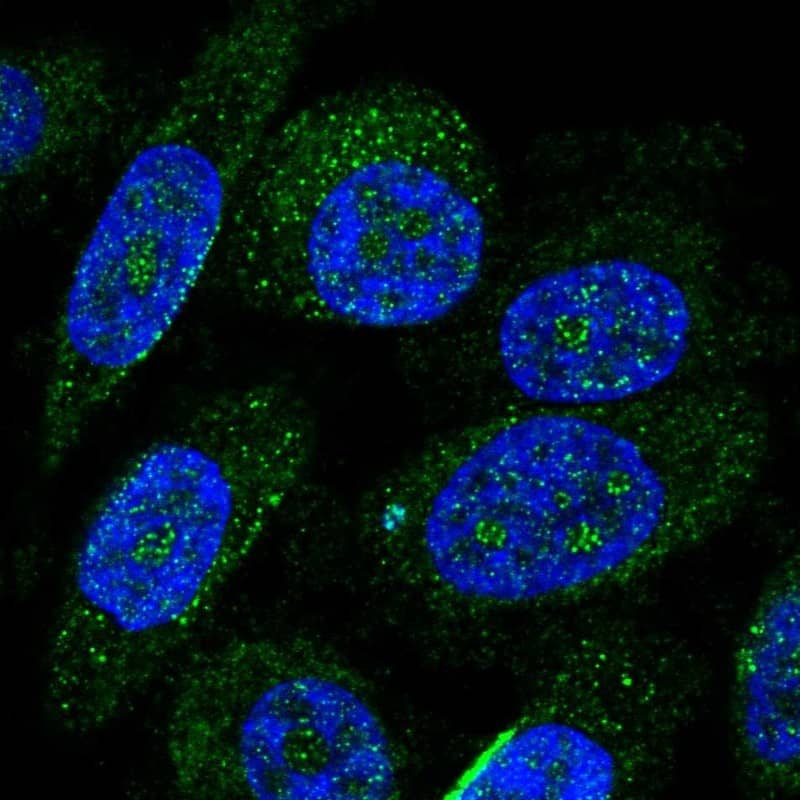 Staining of human cell line PC-3 shows localization to nucleoli fibrillar center & vesicles.