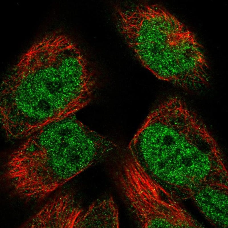 Staining of human cell line RH-30 shows localization to nucleoplasm.