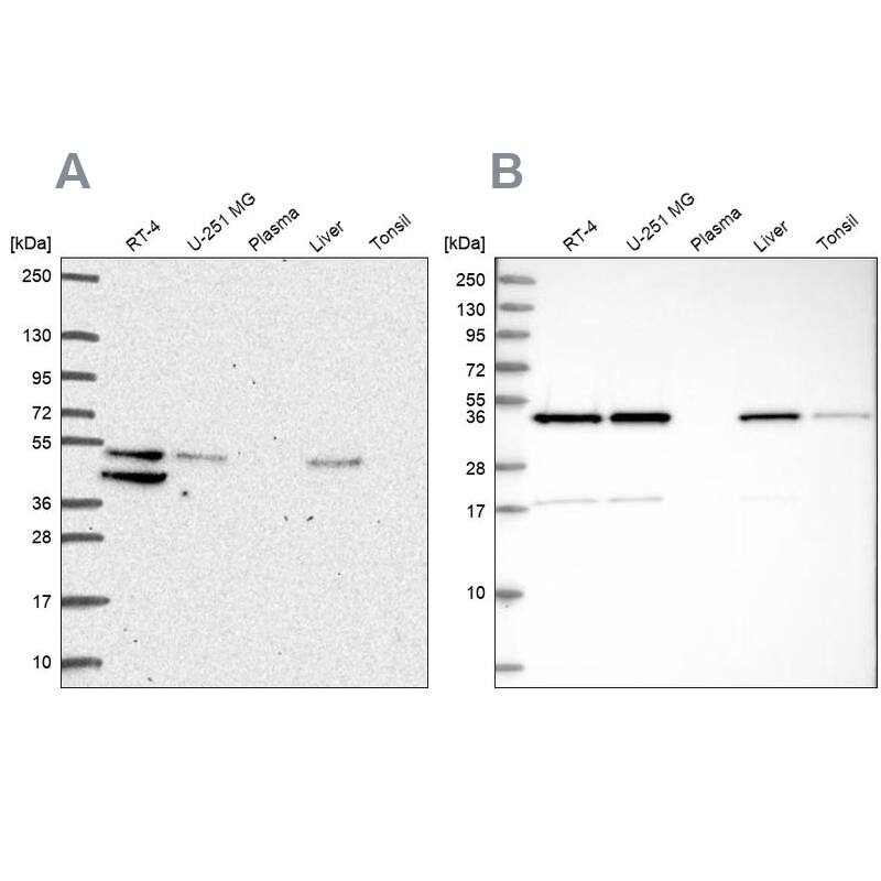 Analysis using NBP2-56525 (A) shows similar pattern to independent antibody NBP2-58695 (B).