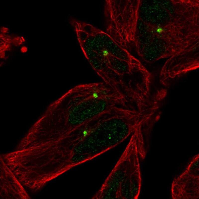 Staining of human cell line RH-30 shows localization to centrosome.