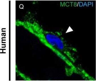 Expression of MCT8 and OATP1C1 in the cerebral barriers of the human and macaque motor cortex. Representative brightfield (A,E,I,M) and fluorescence confocal microscope (B–D,F–H,J–L,N–T) photomicrographs showing immunostaining for MCT8 (A–H,Q–T) and OATP1C1 (I–P) in blood vessels of human and macaque motor cortex. (A,E) show strong MCT8 staining in the endothelial layer of small vessels and capillaries (white arrowheads) in humans and macaques, respectively. (B–D,F–H) show colocalization of MCT8 (green) with the endothelial markers UEA-I (red) and ENG (red). (I,M) show weak OATP1C1 staining in small vessels (white arrowheads) and venules (black arrowheads). The red arrowhead in M points to a glial cell positive for OATP1C1 with processes surrounding the capillary. (J–L,N–P) show colocalization of OATP1C1 (green) with UEA-I (red) and endoglin (red) in a few blood vessels of the human and macaque motor cortex, respectively. White arrowheads point to vessels. In both human and macaque brain tissues, MCT8-immunopositive capillaries are much more abundant than OATP1C1-immunopositive capillaries, which can only be seen occasionally. Moreover, (Q–T) show MCT8-expressing pericytes (white arrowheads) in the human motor cortex that in addition to express MCT8 (green), also show the pericyte biomarker PDGFR-beta  (pink), but not the endothelial marker UEA-I (red). Counterstaining with DAPI (blue) shows nuclei of all cells. ENG: endoglin, UEA-I: Ulex Europaeus Agglutinin-I. PDGFR-beta : platelet-derived growth factor receptor beta. Scale bar = 100 μm (A,E,I,M), 25 μm (B–D), 50 μm (J–L), 120 μm (F–H,N–P), and 12 μm (Q–T). Image collected and cropped by CiteAb from the following open publication (//pubmed.ncbi.nlm.nih.gov/36834621), licensed under a CC-BY license. Not internally tested by Novus Biologicals.