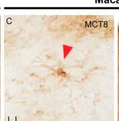 Expression of MCT8 and OATP1C1 in human and macaque motor cortex astrocytes. Representative brightfield (A–E,I) photomicrographs of sections immunostained for MCT8 (A,C) and OATP1C1 (B,D,E,I) in cortical layer I (A–D) and subjacent white matter (E,I). Confocal microscope images of human (F–H) and macaque (J–O) sections double-labeled for OATP1C1 (green) and GFAP (red). Counterstaining with DAPI (blue) shows nuclei of all cells. Note that there is full colocalization of both markers. White and red arrowheads point to astrocytes. Blue arrowheads point to a blood vessel. GFAP: glial fibrillary acidic protein. Scale bar = 50 μm (A–D,J–L), 110 μm (E,I), 25 μm (F–H), and 78 μm (M–O). Image collected and cropped by CiteAb from the following open publication (//pubmed.ncbi.nlm.nih.gov/36834621), licensed under a CC-BY license. Not internally tested by Novus Biologicals.