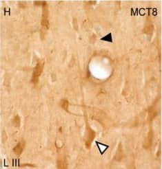 Expression of MCT8 in pyramidal neurons of the human and macaque motor cortex. Representative brightfield photomicrographs show immunostaining for MCT8 in layers III (A), V (B) and VI (C) of the human motor cortex, and layers II (G), III (H), and V (I) of the macaque motor cortex. White arrowheads point to pyramidal neurons with immunopositive signal in the soma, apical and basal dendrites. Black arrowheads point to smaller cells with the morphology of interneurons. (D–F) (human) and (J–L) (macaque) show confocal microscope images from double-stained sections for MCT8 (green) and the pyramidal neuron markers SMI-32 (red) for 200 kDa neurofilament protein or neurogranin/RC3 (red), respectively. White arrowheads point to pyramidal neurons. Counterstaining with DAPI (blue) shows nuclei of all cells. Note that in humans, the MCT8 signal is located mainly in the pyramidal cell membrane, while in macaques it is located in the membrane and the cytoplasm. Scale bar = 50 μm (A), 120 μm (B,I), 25 μm (C–F), 60 μm (G), 62.5 μm (H), and 43.5 μm (J–L). Image collected and cropped by CiteAb from the following open publication (//pubmed.ncbi.nlm.nih.gov/36834621), licensed under a CC-BY license. Not internally tested by Novus Biologicals.