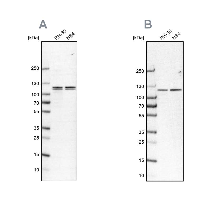 <b>Independent Antibodies Validation. </b>Analysis using NBP2-57388 (A) shows similar pattern to independent antibody NBP1-88195 (B).