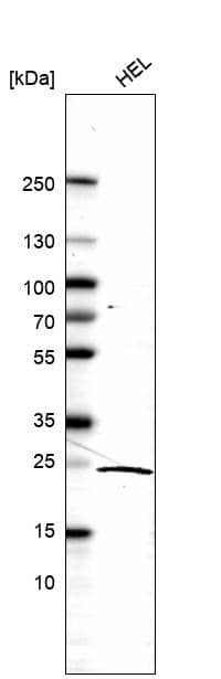 Analysis in human cell line HEL.
