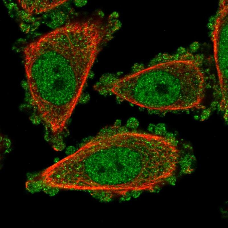 Staining of human cell line PC-3 shows localization to nucleoplasm & cytosol.