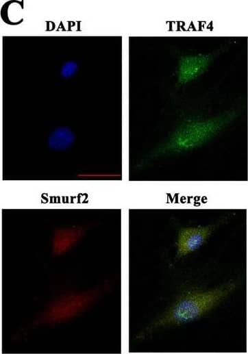TRAF4 diminished the expression of Smurf2 to modulate the osteogenesis process of MSCs. a Coomassie blue staining of the coimmunoprecipitated mixture separated by SDS-PAGE. b Coimmunoprecipitated mixtures were separated by SDS-PAGE and evaluated by western blot. Endogenous TRAF4 and Smurf2 in MSCs interacted with each other. c Immunofluorescence assays showed the colocalization of TRAF4 and Smurf2 in MSCs (green TRAF4, red Smurf2, blue DAPI). d The Smad1 and Runx2 protein levels were decreased in the Sh-TRAF4 group and increased in the Sh-Smurf2 group compared with those in the NC1 group, while compared with Sh-TRAF4, Sh-TRAF4/Sh-Smurf2 rescued the expression of Smad1 and Runx2. The Smad1 and Run2 protein levels increased in the OE-TRAF4 group and decreased in the OE-Smurf2 group compared with the NC2 group, while the expression levels of Smad1 and Runx2 in the OE-TRAF4/OE-Smurf2 group was decreased compared with those observed in the OE-TRAF4 group. e The simultaneous knockdown of TRAF4 and Smurf2 increased the ARS and ALP staining compared with that in the Sh-TRAF4 group (scale bar = 250 um, black arrows), while the simultaneous overexpression of TRAF4 and Smurf2 decreased the ARS and ALP staining to the level observed in the NC2 group compared with OE-TRAF4 group (scale bar = 250 um, black arrows). Data in (d) and (e) are presented as the means +/- SD. *p < 0.05 (n = 3 independent experiments with three different MSC lines) Image collected and cropped by CiteAb from the following open publication (//pubmed.ncbi.nlm.nih.gov/31076633), licensed under a CC-BY license. Not internally tested by Novus Biologicals.