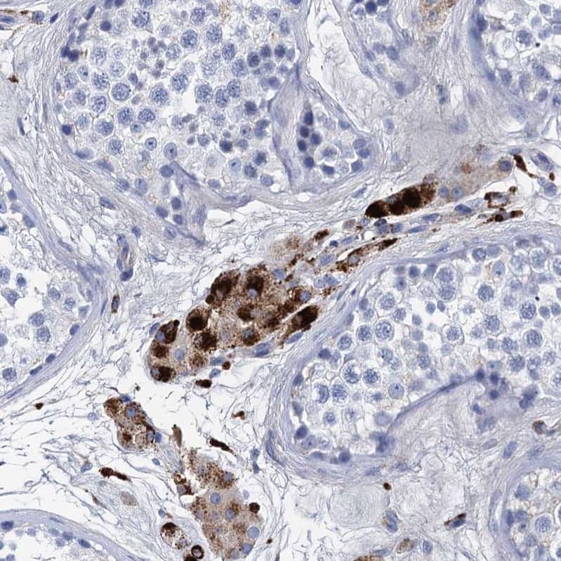 Staining of human testis shows strong cytoplasmic positivity in Leydig cells.