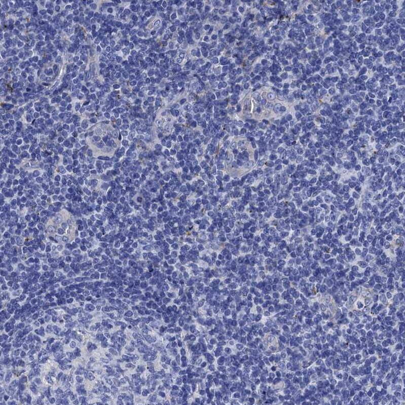 Staining of human tonsil shows no positivity in non-germinal center cells as expected.