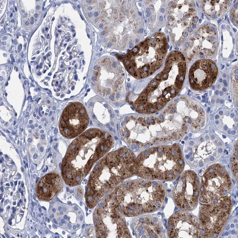 Staining of human kidney shows strong cytoplasmic positivity in cells in tubules.