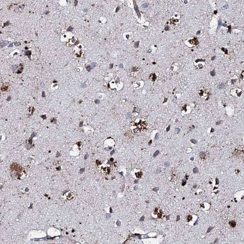 Staining of human cerebral cortex shows strong cytoplasmic positivity in glial cells.
