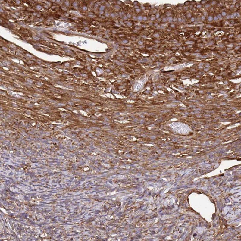 Staining of human ovary shows stroma positivity.