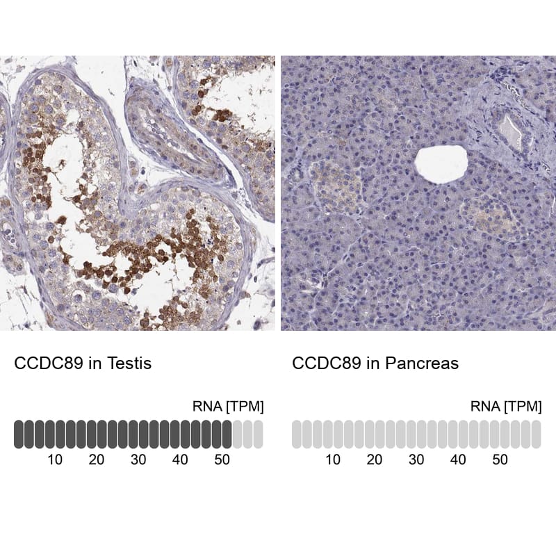 Analysis in human testis and pancreas tissues.